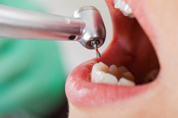 Best Broken or Cracked Tooth Emergency Dentist in Bethel Island, CA